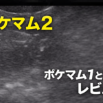 【ポケマム2レビュー】ポケマム1との違いは？iPhoneユーザーが実際に使って比較してみた